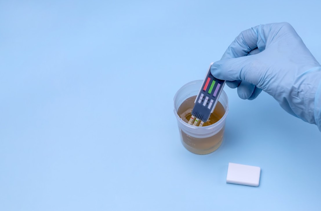 CBD drug test: does it detect?