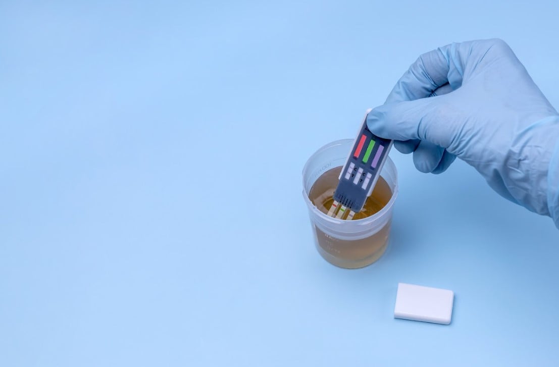 CBD drug test: does it show?