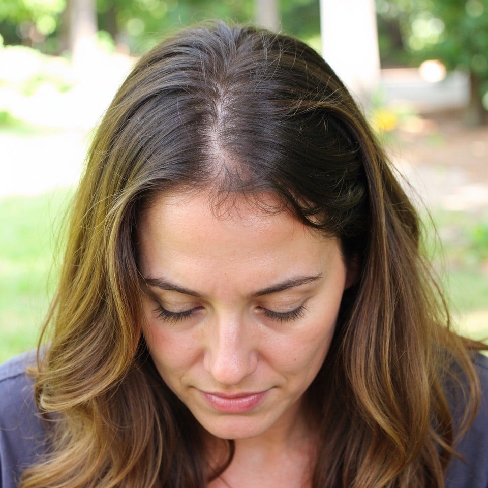 Causes of Hair Loss in Women