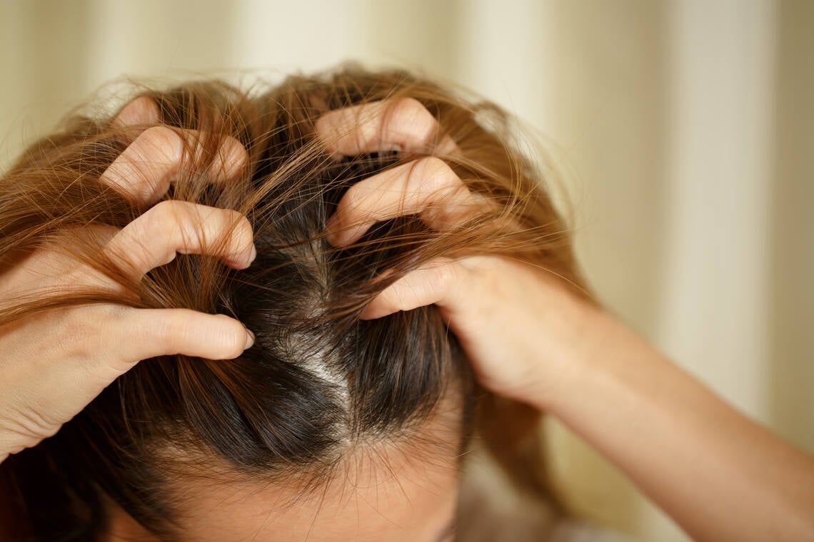 Scalp itch being treated with collagen product